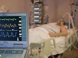 Ventilazione Meccanica con 10 ECM Le curve che tolgono il fiato